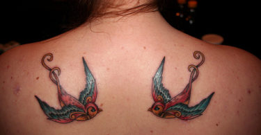 Tattoo removal in Barcelona