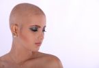 greffe de cheveux